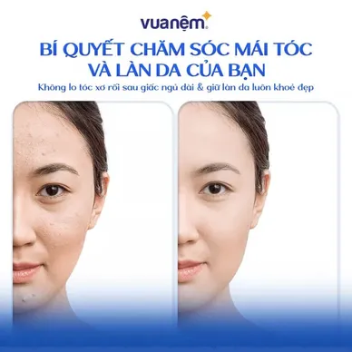 Combo Gối ôm Poppy kèm vỏ gối cooling - Ảnh 12